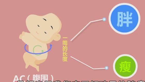 四维彩超那么贵,准妈妈要看懂,不然钱白花了!