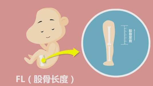 四维彩超那么贵,准妈妈要看懂,不然钱白花了!