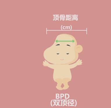 四维彩超那么贵,准妈妈要看懂,不然钱白花了!