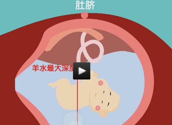四维彩超那么贵,准妈妈要看懂,不然钱白花了!