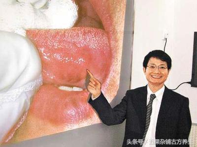 为什么吃槟榔“头发晕，脸发红，心跳加速”可能加了这两种东西