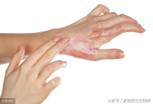 被开水烫伤该怎么办?妈妈用一急救方法,连医生都点赞,建议收藏