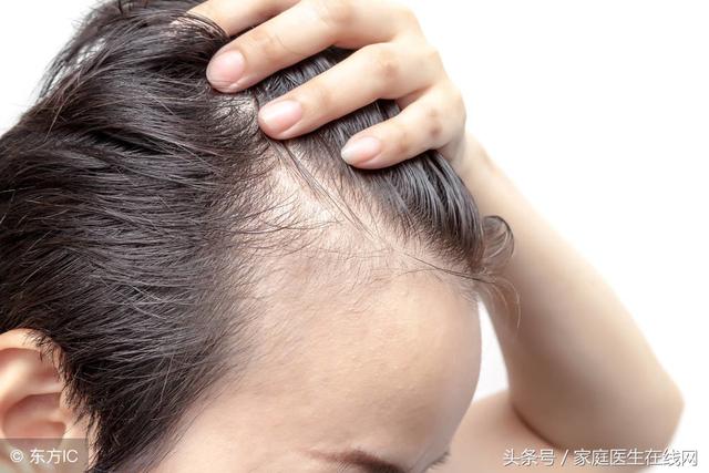 每天大把掉头发怎么办?平常注意这3点,再不用当“光头强”