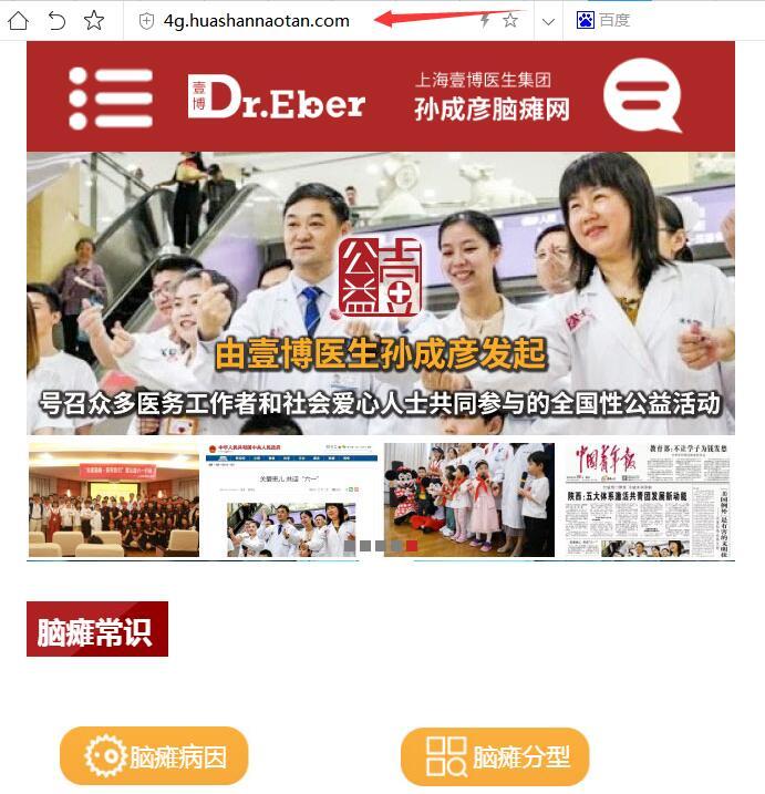 脑瘫
