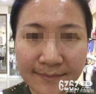 山根有横纹会怎样_山根有横纹如何化解?